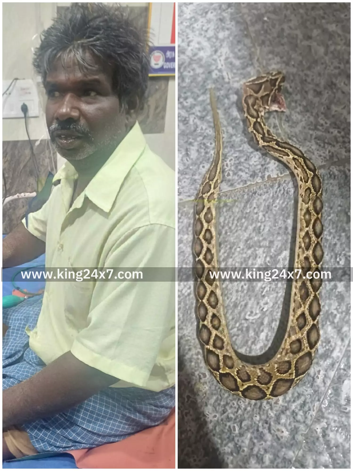 இது தாங்க கடிச்சது பாம்புடன் வந்தவரால் அதிர்ச்சி