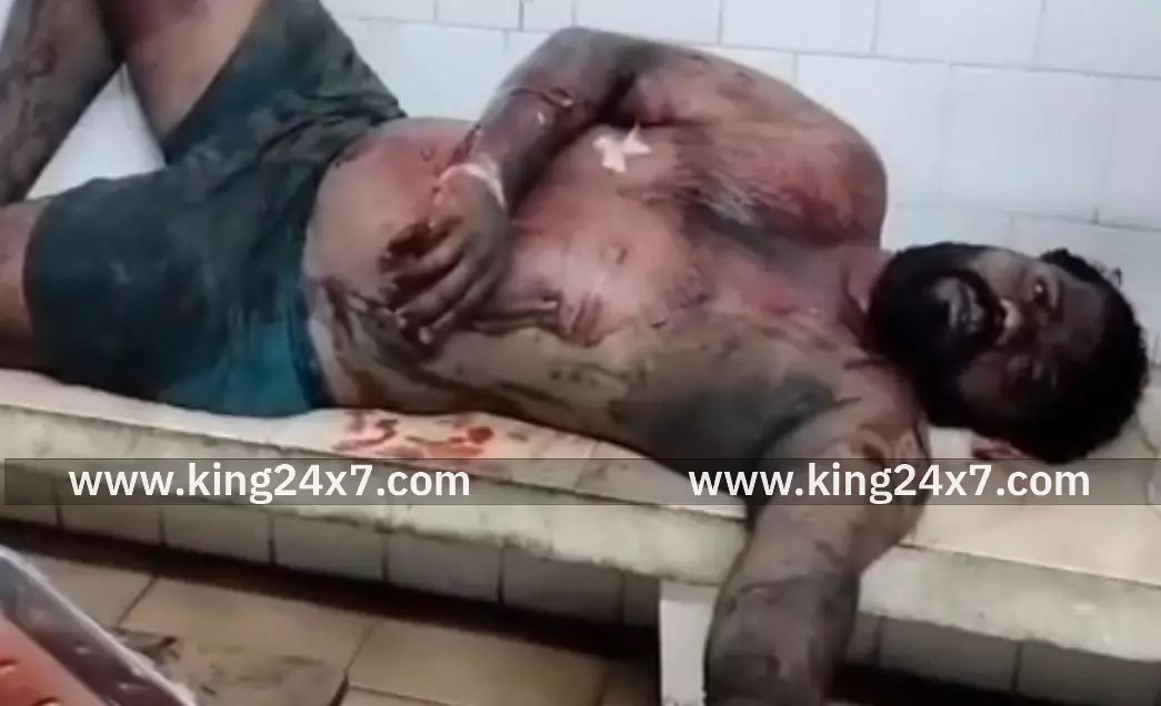 பன்றி இறைச்சி கடை வைப்பதில் தகராறு - வாலிபருக்கு அரிவாள் வெட்டு