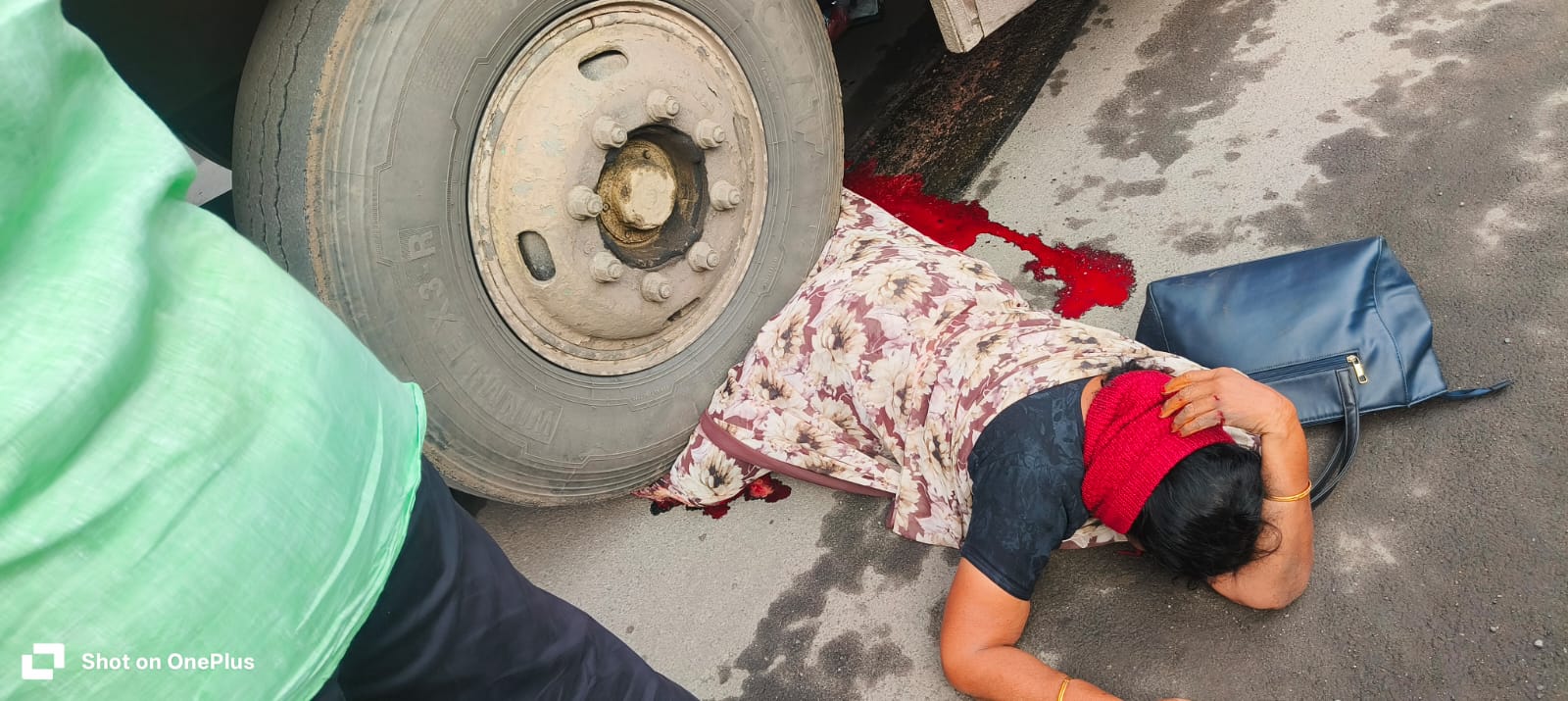 திருச்செங்கோடு புதிய பேருந்து நிலையம் காமராஜர் சிலை அருகே சாலையை கடக்க முயன்ற 61வயது பெண் மீது நகர பேருந்து மோதல் முன்பக்க சக்கரத்தில் சிக்கியதில் பெண்ணின் இரு கால்களும் சேதம்