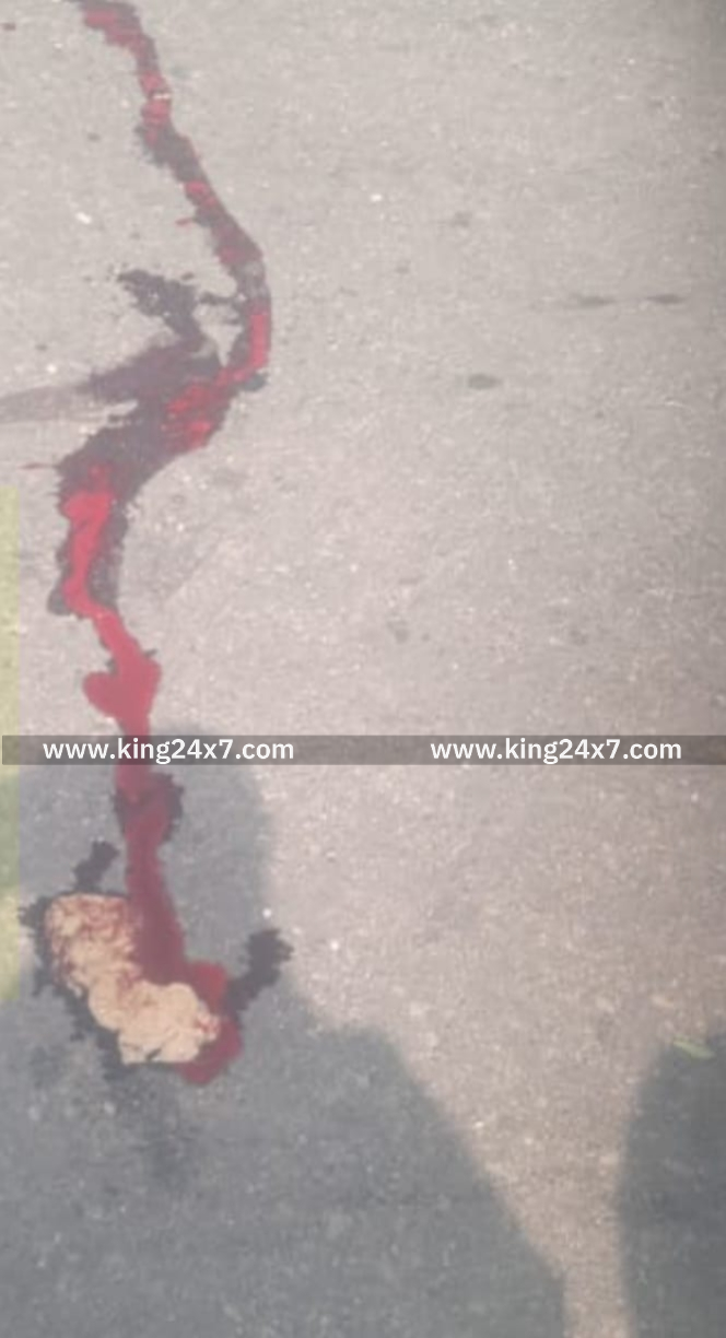 திண்டுக்கல் அருகே சாலையை கடக்க முயன்ற வாலிபர் மீது லாரி மோதிய விபத்தில் வாலிபர் பலி